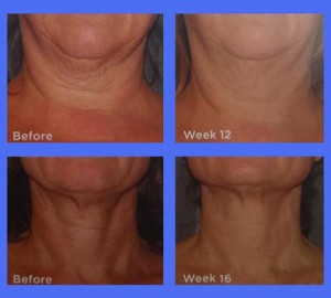 final neck cream pic